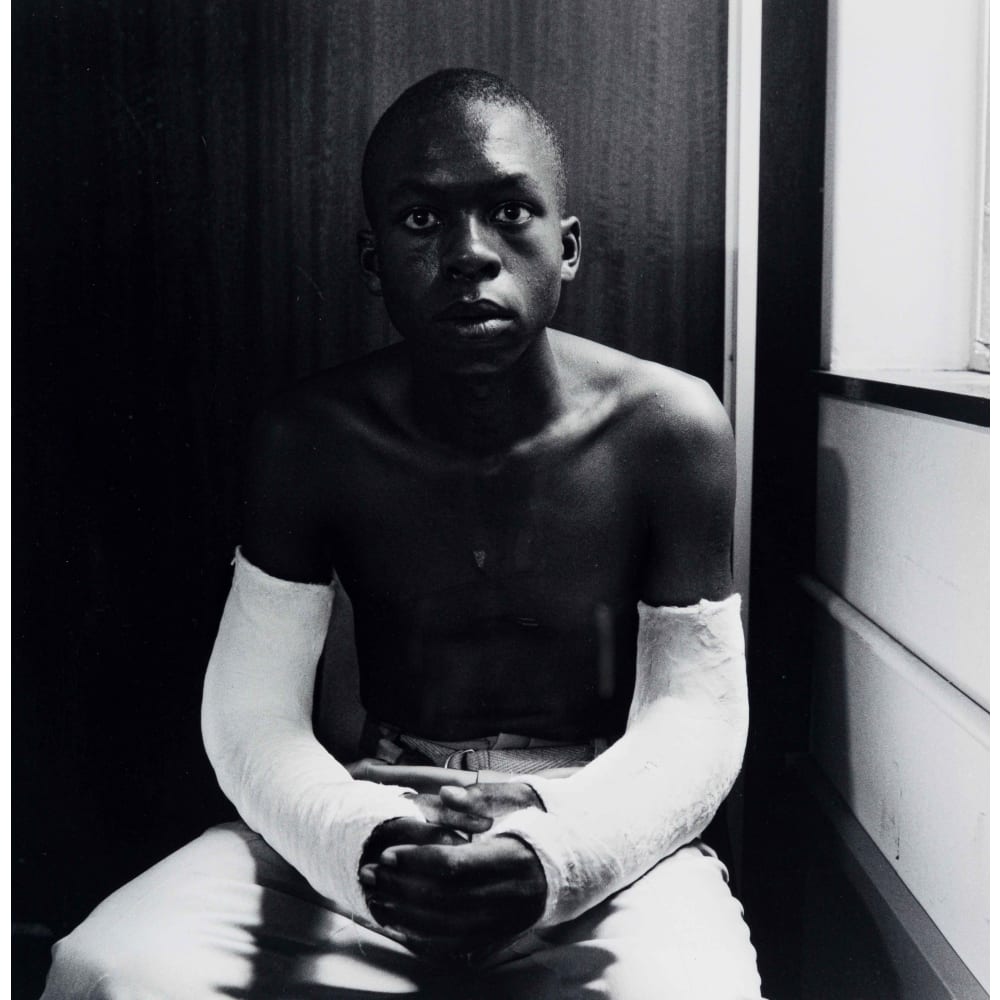 Fifteen-year-old Lawrence Matjee after his assault and detention by the Security Police, Khotso House, De Villiers Street